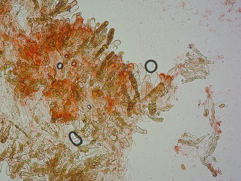 Inosperma-bongardii-06-Cheilo-Spore-RC-200x.jpg