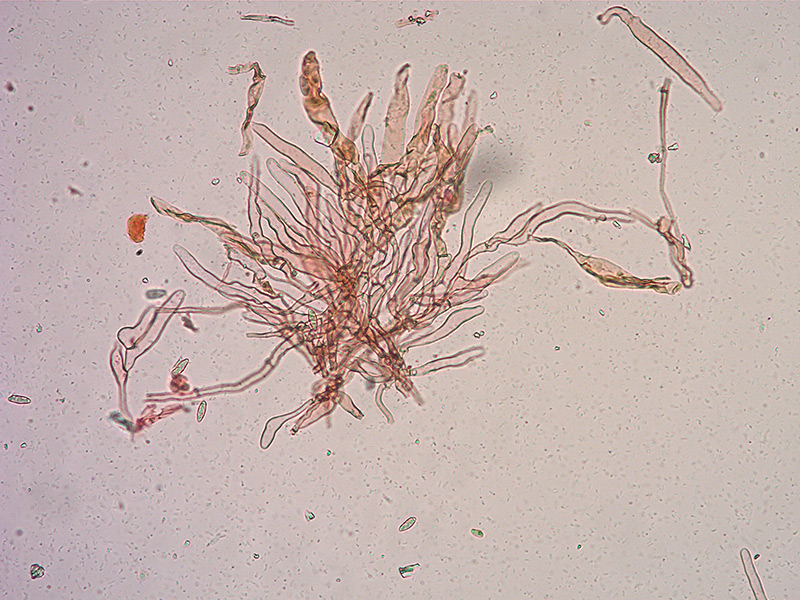 Lepiota-castanea-06-Pileipellis-RC-200x.jpg