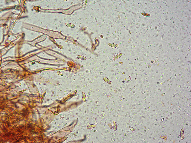 Lepiota-castanea-09-Spore-RC-400x.jpg