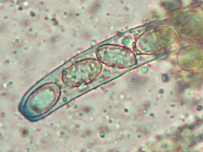 Paragalactinia-succosella-07--Asco-spore-parafisi-Melzer-200x-CROP1.jpg