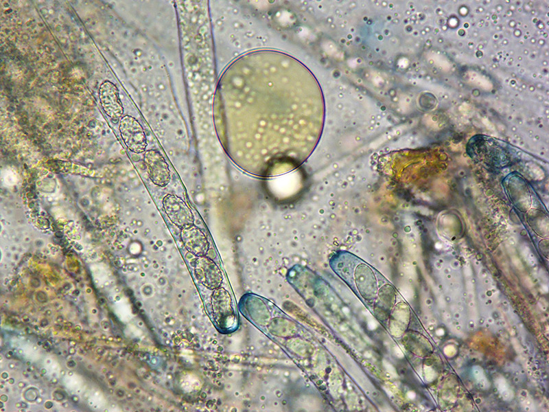 Paragalactinia-succosella-10-Asco-spore-parafisi-Melzer-400x.jpg