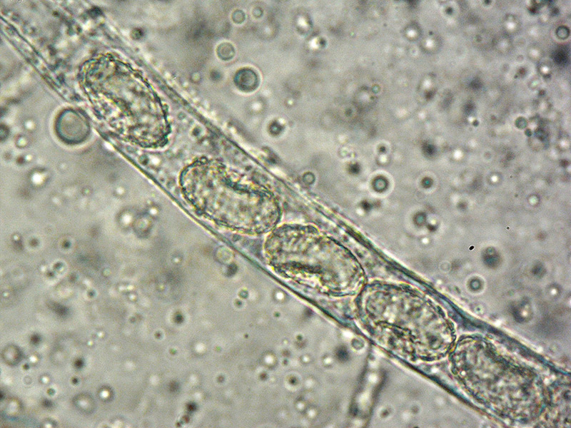 Paragalactinia-succosella-12-Asco-spore-parafisi-Melzer-1000x.jpg