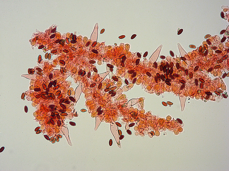 Psathyrella-cfr-bipellis-22Cheilo-spore-RC-200x.jpg