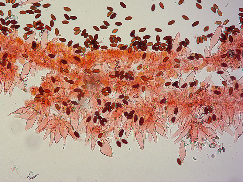 Psathyrella-cfr-bipellis-23Cheilo-spore-RC-200x.jpg