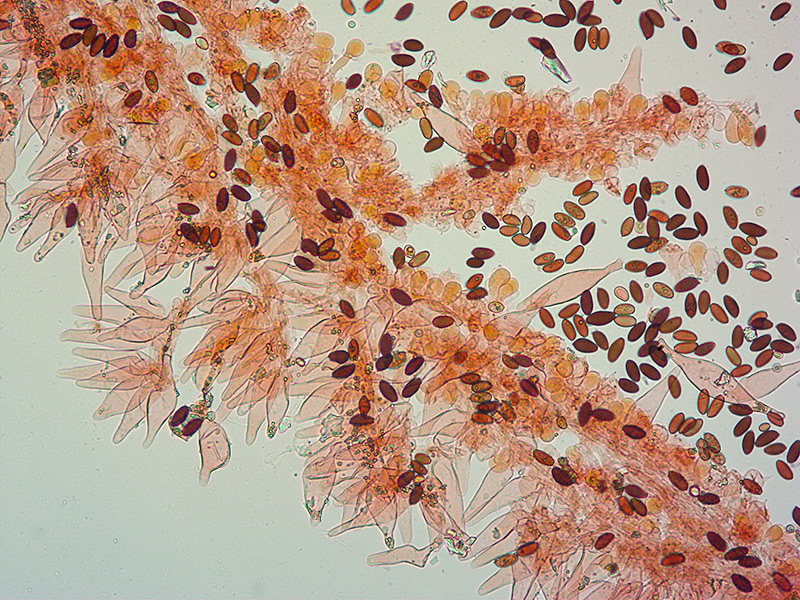 Psathyrella-cfr-bipellis-25Cheilo-spore-RC-200x.jpg