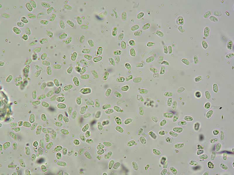 Resupinatus-niger-77-Spore-400x-L4.jpg