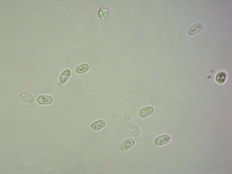 Resupinatus-niger-92-Spore-1000x-L4.jpg