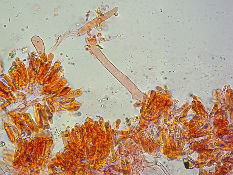Marasmiellus-ramealis-19-23-SubPileipellis-ife-incrostate-RC-400×.jpg