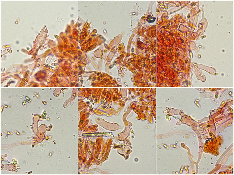 Marasmiellus-ramealis-25-30-Pileipellis-ife-Ramealis-struct-RC-400×.jpg