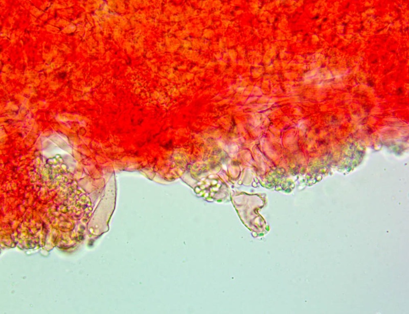 Cheilocistidi(1).thumb.jpg.66120cdb187ad935dbfcf72e9d3ce4ab.jpg