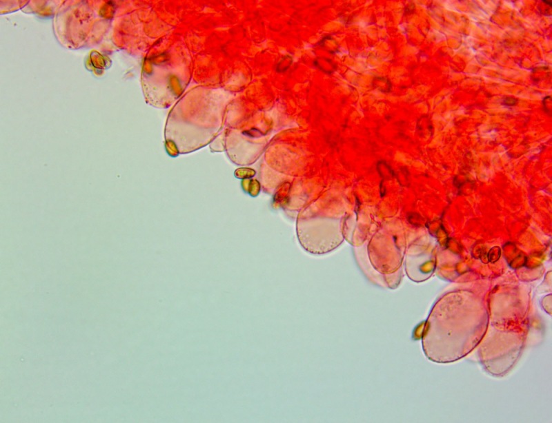 Cheilocistidi(1).thumb.jpg.fb36e746d19bfff085f79c5ee7511bd5.jpg