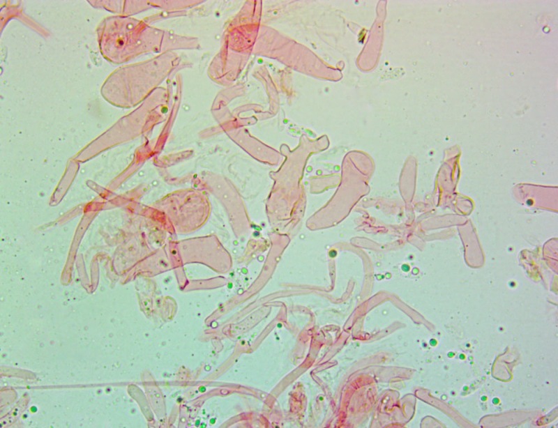 Cheilocistidi(10).thumb.jpg.19e5f383c4cea863e4a073791c542d4a.jpg