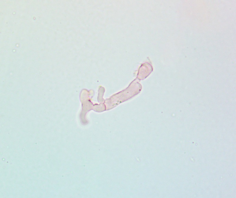 Cheilocistidi(2).thumb.jpg.22e409b9c19ba4ca25347e56d3447f2d.jpg