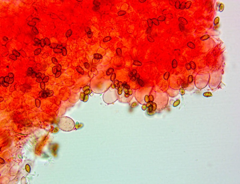 Cheilocistidi(2).thumb.jpg.53d606bb2d215b3c9b96b335632f9691.jpg