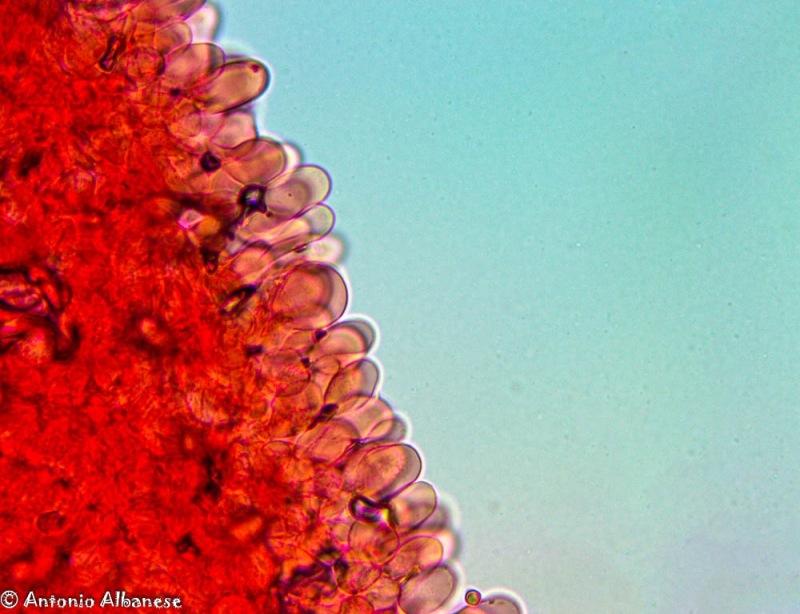 Cheilocistidi(2).thumb.jpg.91ab489f38f262526c4df6e8b51a22d7.jpg