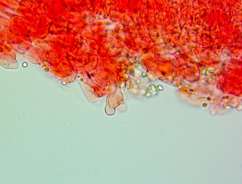 Cheilocistidi(2).thumb.jpg.fb8709df3fb064cbfb93d92650ac0c57.jpg