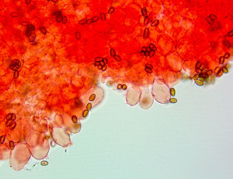Cheilocistidi(3).thumb.jpg.03d61051a65a5b5af67ea36ea98f0f18.jpg