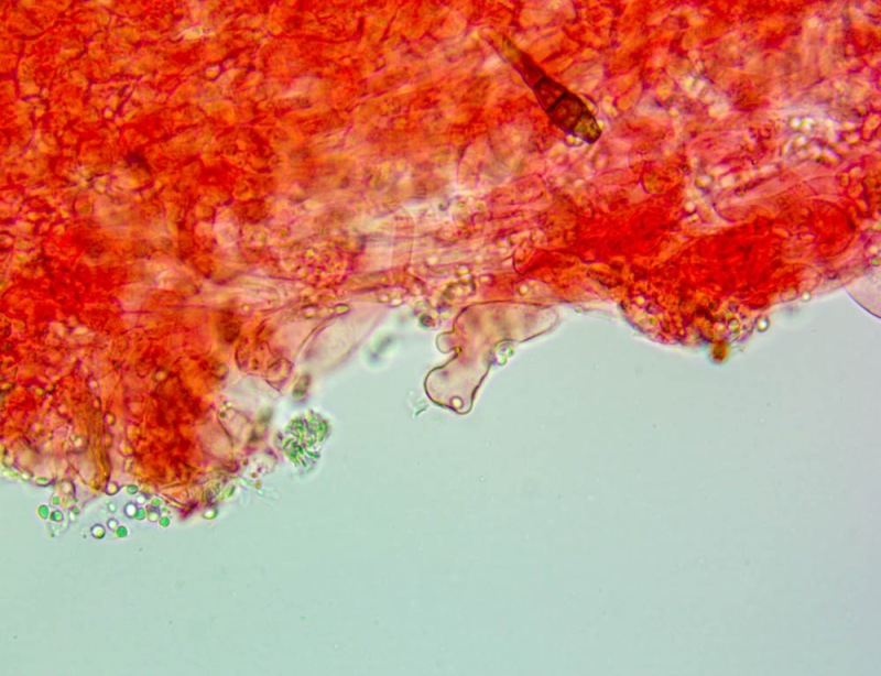 Cheilocistidi(3).thumb.jpg.4c3e8d8964c1047e686e6fdfc4bcab6f.jpg