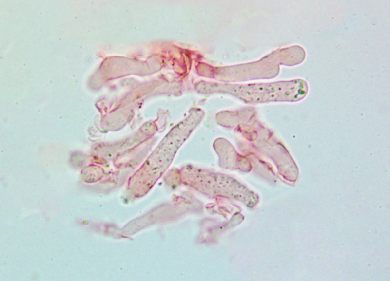 Cheilocistidi(3).thumb.jpg.6fd1a47fb64f7812736915e6293e57a7.jpg