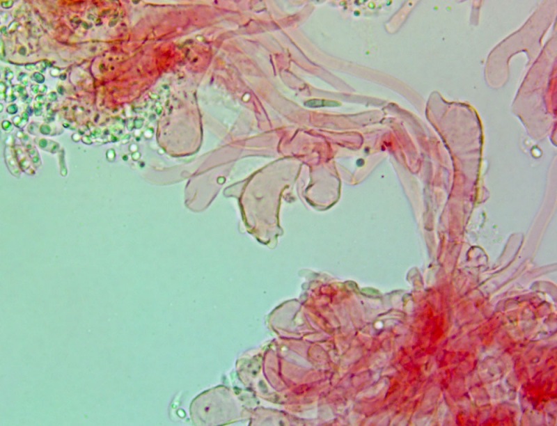 Cheilocistidi(4).thumb.jpg.c5094c463620ed9e16d830a9f4da0f93.jpg