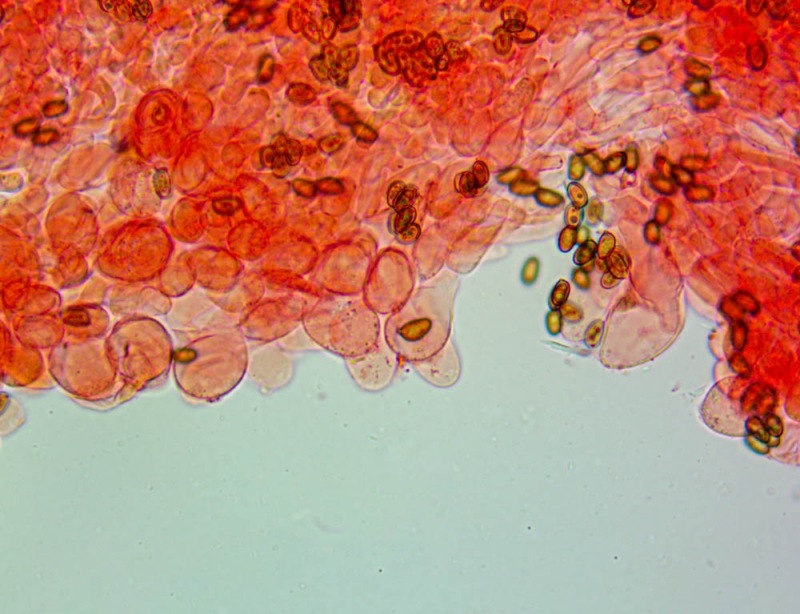 Cheilocistidi(4).thumb.jpg.eddcdd465bdd251ebac465545d0d128c.jpg