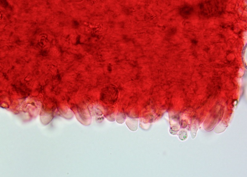 Cheilocistidi(5).thumb.jpg.2a671127b03e8e5a33262dc9c92af98e.jpg