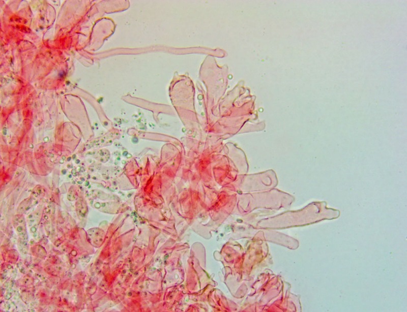 Cheilocistidi(5).thumb.jpg.750f9277ee0c00a43f7ff20c1044040e.jpg