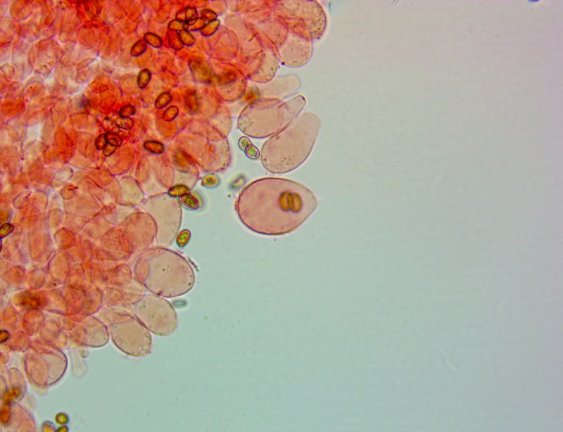 Cheilocistidi(5).thumb.jpg.e61fdfd1c4916e218594e9f64d48fc7b.jpg