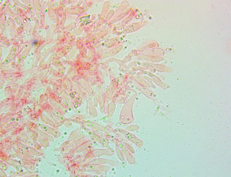 Cheilocistidi(6).thumb.jpg.f388c5a243453acb8c6b5c4af31f7bfb.jpg