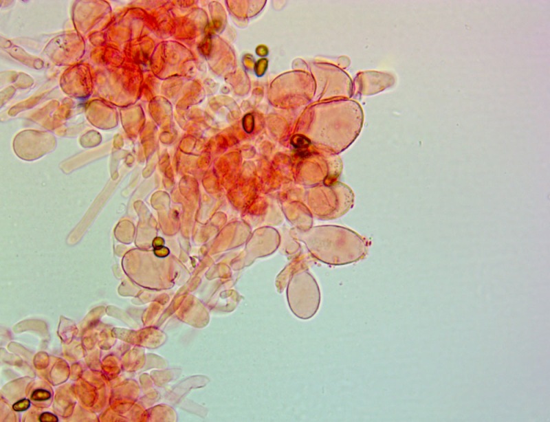 Cheilocistidi(7).thumb.jpg.7d0e15f6d317a0311cf25abcf99cec49.jpg