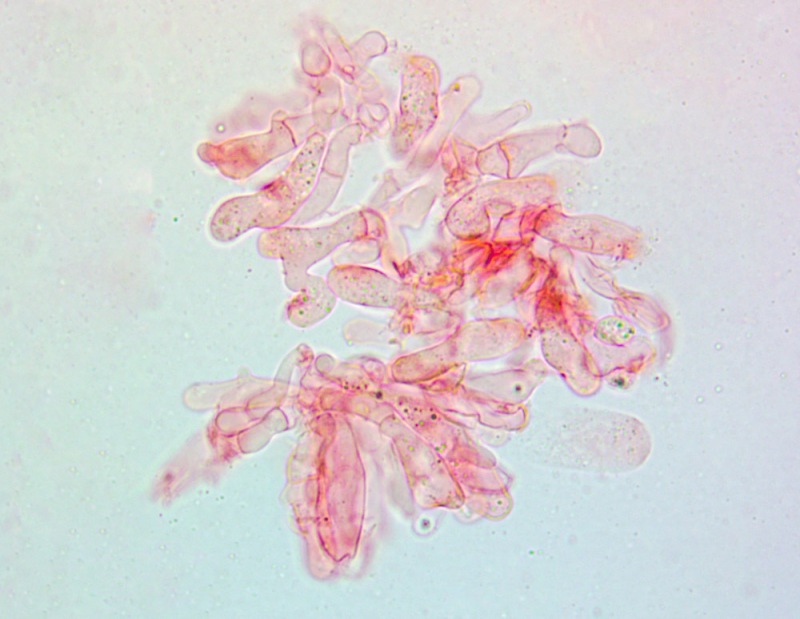 Cheilocistidi(7).thumb.jpg.a50509d1ed1a640b292da8ce820b54fb.jpg