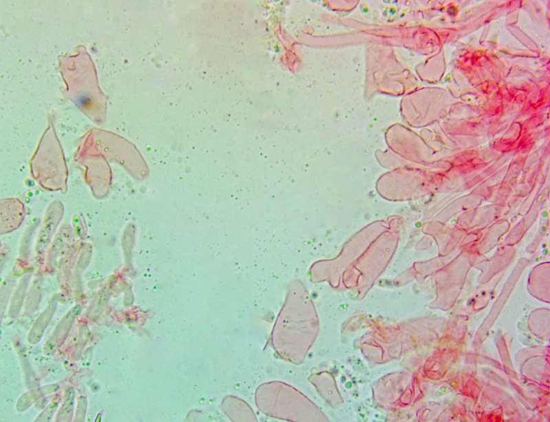 Cheilocistidi(7).thumb.jpg.c37adba8219760d7fd1f965861bfef15.jpg