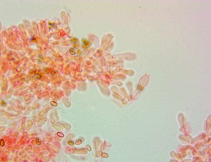 Cheilocistidi(8).thumb.jpg.9b53caf43c198e68fe0f7947754f0c6a.jpg