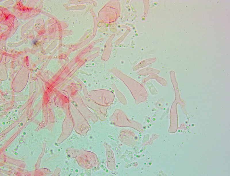 Cheilocistidi(8).thumb.jpg.aed0911739e80a277e45c1d2639f6a1a.jpg