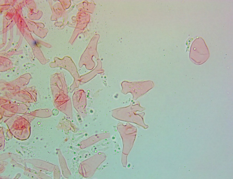 Cheilocistidi(9).thumb.jpg.c6f7716cb25ca1cf88735117884ca219.jpg