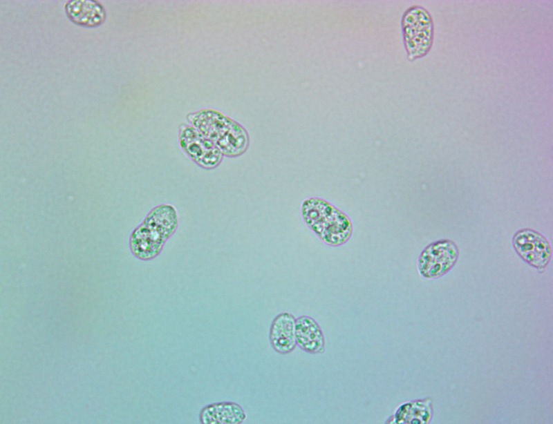 Spore100x(2).thumb.jpg.f19331410a0f7534ee149ea4e7a16957.jpg