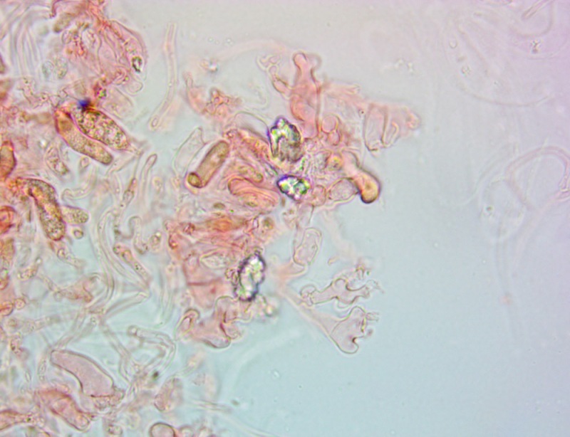 Cheilocistidi63x(1).thumb.jpg.86979305a1b0ecb83274ac5b12f04d3e.jpg