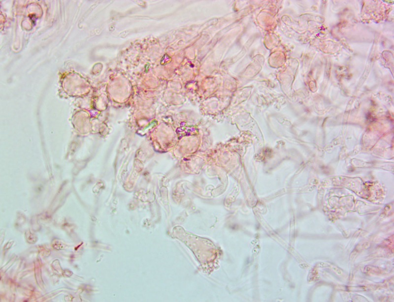 Cheilocistidi63x(10).thumb.jpg.1c9094f21ad9bf43dd2f2507eec7b2b0.jpg