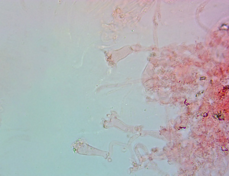 Cheilocistidi63x(2).thumb.jpg.db69f65c4da1298b9d4eddd8728b4780.jpg