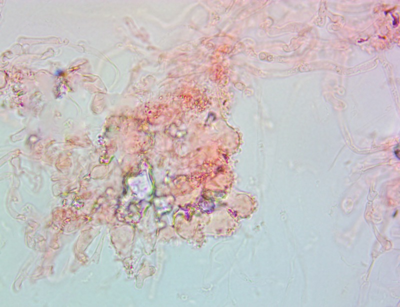Cheilocistidi63x(3).thumb.jpg.b76be894f4965139ac1b204928c3da14.jpg