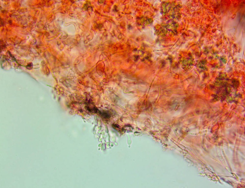 Cheilocistidi63x(5).thumb.jpg.ce87e7deea368ca41eb1e05b7ebb9b69.jpg