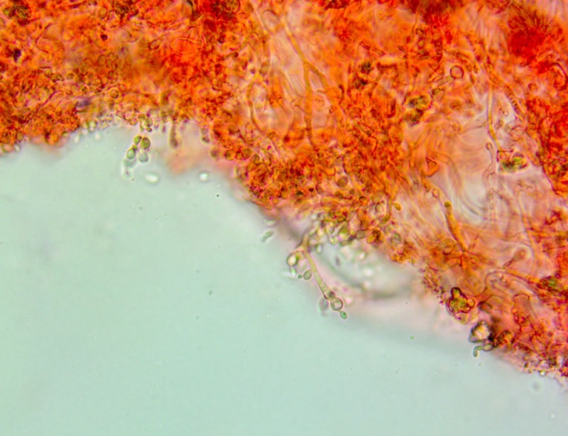 Cheilocistidi63x(6).thumb.jpg.6982bb941eb0733c3183afe59507ea7b.jpg
