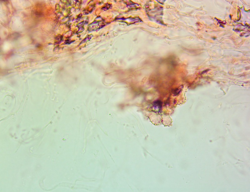 Cheilocistidi63x(7).thumb.jpg.0673c732fa78db7684b6e26a17b11bb9.jpg