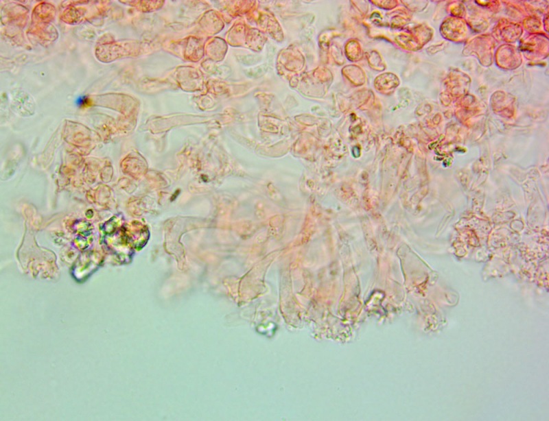 Cheilocistidi63x(8).thumb.jpg.46bfefb8c4c4888f6cf8a5ab7f70b97e.jpg