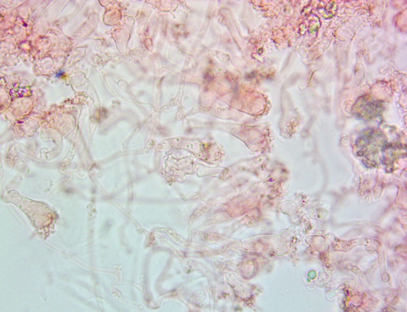 Cheilocistidi63x(9).thumb.jpg.c78b3560548e41dc2d62b34c46947af8.jpg