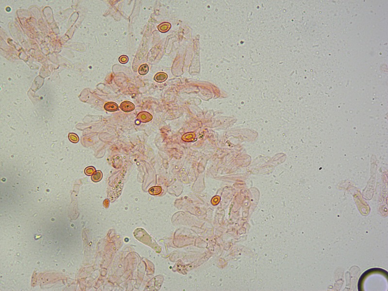 Chlorophyllum-brunneum-29-spore-RC-400x.jpg