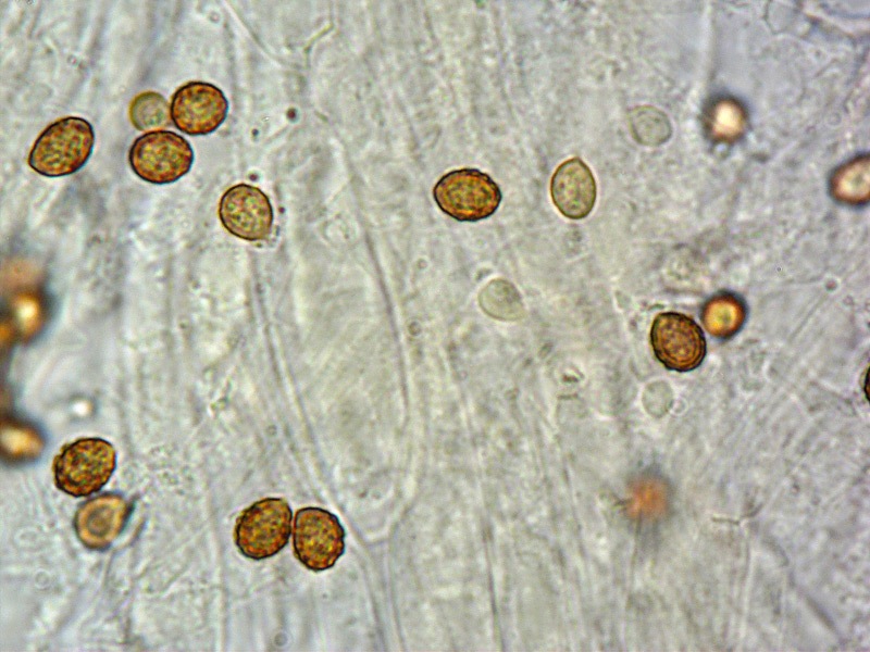 Cortinarius-melanotus-(Leprocybe)-15-Spore-KOH-1000x.jpg