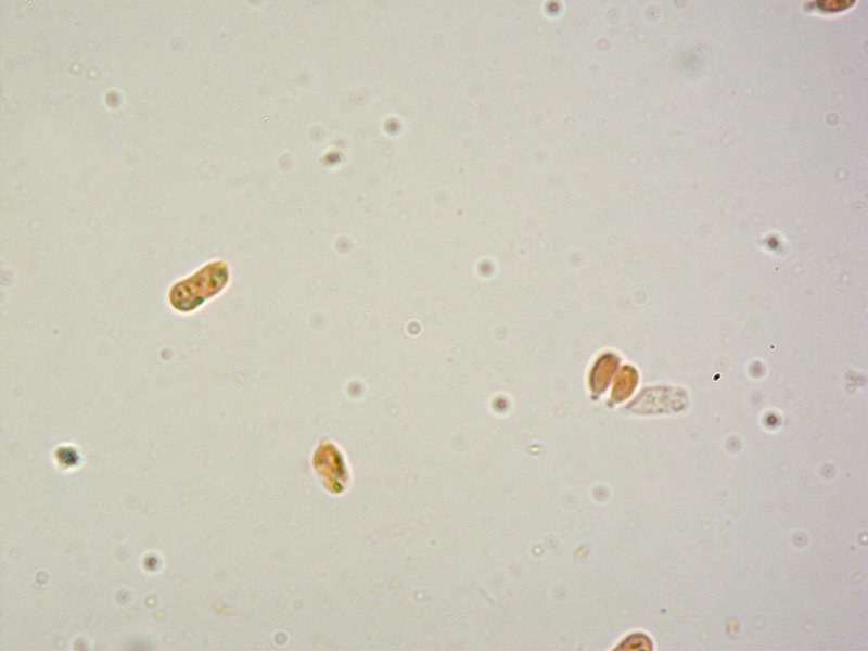 Hygrocybe-insipida-25-Spore-RC-1000x.jpg