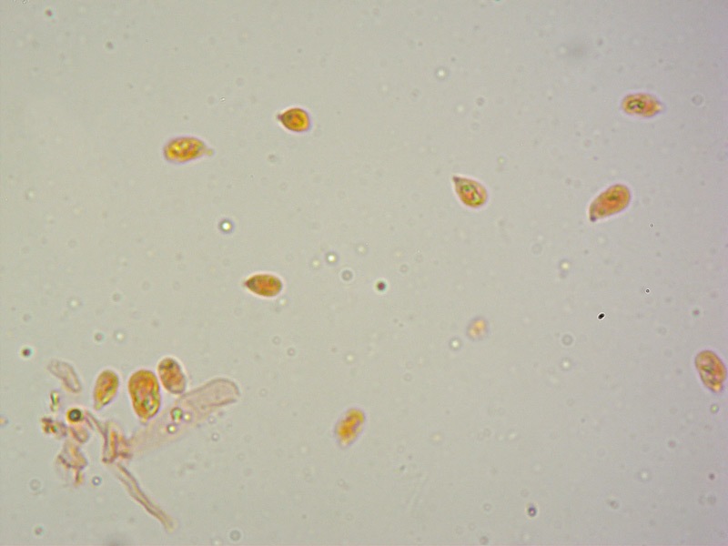 Hygrocybe-insipida-27-Spore-RC-1000x.jpg