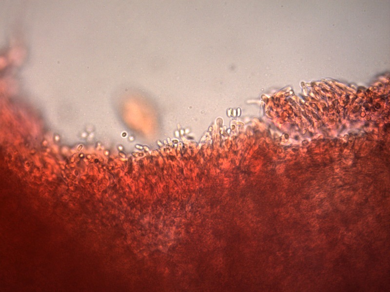 Rhodonia-placenta-basidi-1_400x.jpg